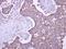 Malectin antibody, GTX102021, GeneTex, Immunohistochemistry paraffin image 