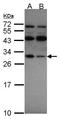 40S ribosomal protein S4, X isoform antibody, orb69791, Biorbyt, Western Blot image 