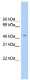 TRNA Methyltransferase 10C, Mitochondrial RNase P Subunit antibody, TA343860, Origene, Western Blot image 