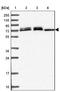 Glutamate Rich 6B antibody, NBP2-31011, Novus Biologicals, Western Blot image 