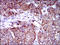 Enhancer Of Zeste 2 Polycomb Repressive Complex 2 Subunit antibody, orb329985, Biorbyt, Immunohistochemistry paraffin image 