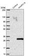 Anaphase Promoting Complex Subunit 15 antibody, NBP1-84151, Novus Biologicals, Western Blot image 