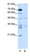 Forkhead Box N2 antibody, orb324753, Biorbyt, Western Blot image 