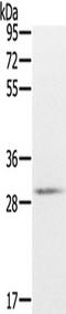 CXXC Finger Protein 5 antibody, TA349840, Origene, Western Blot image 