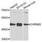 Cholinergic Receptor Nicotinic Beta 2 Subunit antibody, orb374245, Biorbyt, Western Blot image 