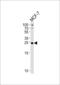 3-Hydroxyacyl-CoA Dehydratase 2 antibody, 61-738, ProSci, Western Blot image 