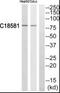 NIMA Related Kinase 5 antibody, PA5-39439, Invitrogen Antibodies, Western Blot image 