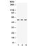 5-Hydroxytryptamine Receptor 2A antibody, R32043, NSJ Bioreagents, Western Blot image 
