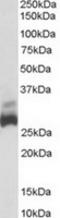 DHSB antibody, TA302600, Origene, Western Blot image 
