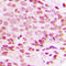 Jun Proto-Oncogene, AP-1 Transcription Factor Subunit antibody, LS-C354025, Lifespan Biosciences, Immunohistochemistry paraffin image 