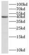 BRMS1 Like Transcriptional Repressor antibody, FNab00961, FineTest, Western Blot image 