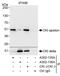Casein Kinase 1 Epsilon antibody, A302-135A, Bethyl Labs, Immunoprecipitation image 