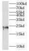 Mitochondrial Ribosomal Protein L21 antibody, FNab05321, FineTest, Western Blot image 