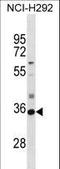 DHEA-ST antibody, LS-C161609, Lifespan Biosciences, Western Blot image 