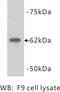 PiggyBac transposable element-derived protein 5 antibody, MBS355128, MyBioSource, Western Blot image 