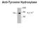 Tyrosine Hydroxylase antibody, 50-262, ProSci, Western Blot image 