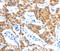 Lymphatic Vessel Endothelial Hyaluronan Receptor 1 antibody, MBS2518018, MyBioSource, Immunohistochemistry paraffin image 