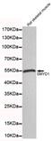 SET And MYND Domain Containing 1 antibody, MBS475104, MyBioSource, Western Blot image 