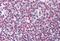 KH-Type Splicing Regulatory Protein antibody, MBS246006, MyBioSource, Immunohistochemistry paraffin image 