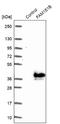 Family With Sequence Similarity 151 Member B antibody, NBP1-90647, Novus Biologicals, Western Blot image 