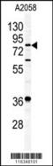Acylaminoacyl-Peptide Hydrolase antibody, 56-505, ProSci, Western Blot image 