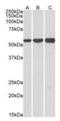 3-Hydroxy-3-Methylglutaryl-CoA Synthase 1 antibody, orb334063, Biorbyt, Western Blot image 