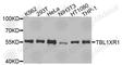 Transducin Beta Like 1 X-Linked Receptor 1 antibody, A9922, ABclonal Technology, Western Blot image 
