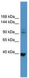 Leukocyte tyrosine kinase receptor antibody, TA342899, Origene, Western Blot image 