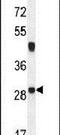 Neurocalcin Delta antibody, PA5-23997, Invitrogen Antibodies, Western Blot image 