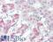 SLIT And NTRK Like Family Member 6 antibody, LS-B3220, Lifespan Biosciences, Immunohistochemistry paraffin image 