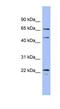 Mitogen-Activated Protein Kinase 4 antibody, NBP1-58082, Novus Biologicals, Western Blot image 