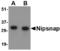 Protein NipSnap homolog 1 antibody, LS-C53280, Lifespan Biosciences, Western Blot image 