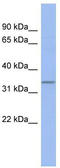 Chromosome 17 Open Reading Frame 78 antibody, TA331405, Origene, Western Blot image 