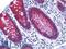 Cadherin 17 antibody, LS-B6022, Lifespan Biosciences, Immunohistochemistry paraffin image 