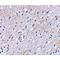 BAI1 Associated Protein 3 antibody, LS-C53271, Lifespan Biosciences, Immunohistochemistry paraffin image 