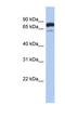Myotubularin Related Protein 12 antibody, NBP1-54988, Novus Biologicals, Western Blot image 