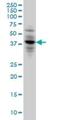 Calcium Voltage-Gated Channel Auxiliary Subunit Gamma 3 antibody, H00010368-M01, Novus Biologicals, Western Blot image 