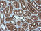 Melan-A antibody, LS-C174643, Lifespan Biosciences, Immunohistochemistry paraffin image 