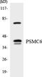 Proteasome 26S Subunit, ATPase 6 antibody, LS-C200539, Lifespan Biosciences, Western Blot image 