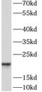 Anti-Silencing Function 1A Histone Chaperone antibody, FNab00632, FineTest, Western Blot image 
