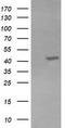 Potassium Voltage-Gated Channel Subfamily A Member Regulatory Beta Subunit 1 antibody, CF503970, Origene, Western Blot image 