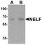 Nasal embryonic luteinizing hormone-releasing hormone factor antibody, PA5-34508, Invitrogen Antibodies, Western Blot image 
