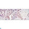 STAT3 antibody, LS-C812781, Lifespan Biosciences, Immunohistochemistry paraffin image 