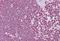 CD40 Ligand antibody, NBP1-59186, Novus Biologicals, Immunohistochemistry paraffin image 