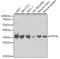 Protein Phosphatase 4 Catalytic Subunit antibody, A2109, ABclonal Technology, Western Blot image 