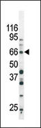 SMAD Family Member 3 antibody, AP12710PU-N, Origene, Western Blot image 