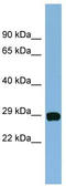 Coiled-Coil-Helix-Coiled-Coil-Helix Domain Containing 3 antibody, TA344962, Origene, Western Blot image 