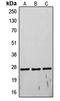 TIMP Metallopeptidase Inhibitor 4 antibody, LS-C352945, Lifespan Biosciences, Western Blot image 