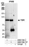 Pre-rRNA-processing protein TSR1 homolog antibody, A305-116A, Bethyl Labs, Immunoprecipitation image 