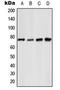 p65 antibody, LS-C354093, Lifespan Biosciences, Western Blot image 